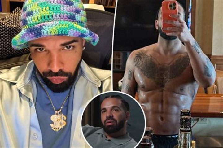 Drake | Surgery Rumors 2024