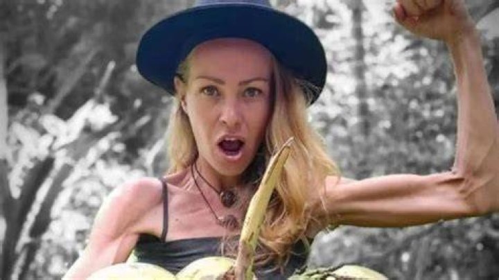 Zhanna Samsonova Anorexia